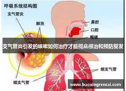 支气管炎引发的咳嗽如何治疗才能彻底根治和预防复发