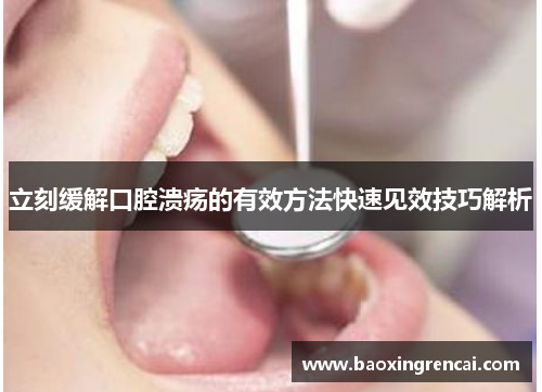 立刻缓解口腔溃疡的有效方法快速见效技巧解析